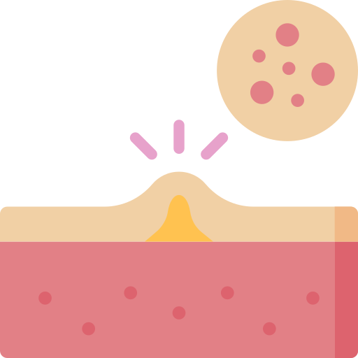 Mụn & các thể mụn