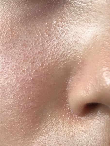 Lỗ chân lông rõ hơn