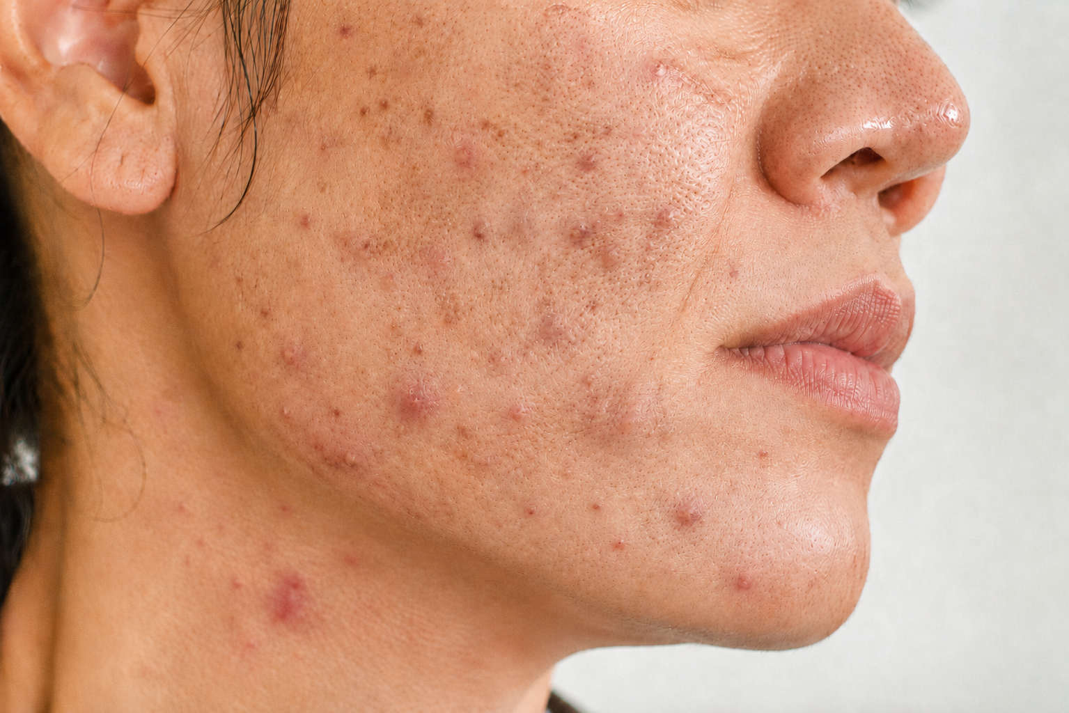 Trước điều trị